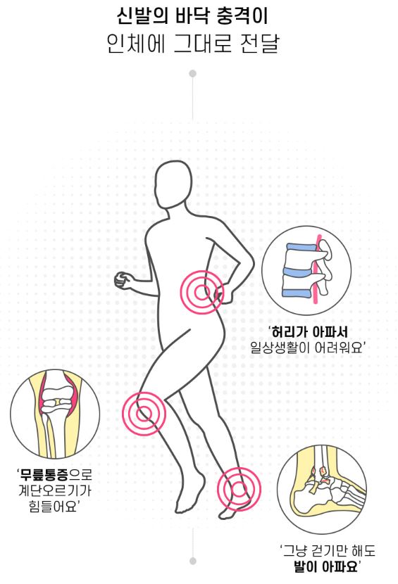 기술 디테일 이미지